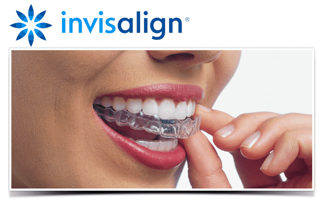 Invisalign near me Greenwich